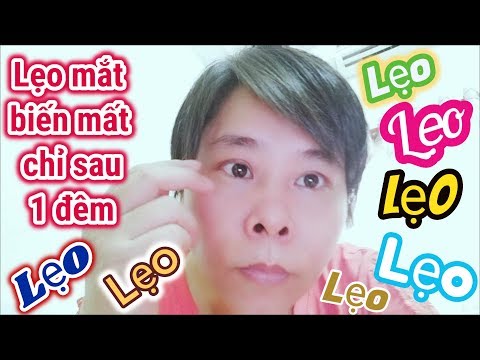 Video: Lẹo mắt ở mí mắt trên: cách điều trị