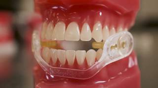 Which Dental Guard Is The Right Fit? Which Dental Guard Is The Right Fit?