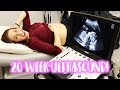 20 Week Pregnancy Anatomy Scan - 4D Ultrasound!