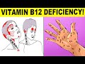 Vitamin B12 Deficiency Symptoms That Should Never Be Ignored