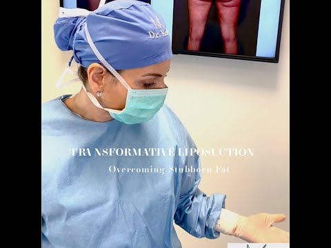 Transformative Liposuction: Overcoming stubborn fat #liposuction #bodycontouring #cosmeticsurgery