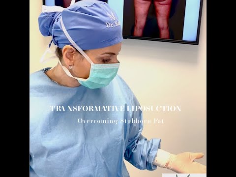 Transformative Liposuction: Overcoming stubborn fat #liposuction #bodycontouring #cosmeticsurgery