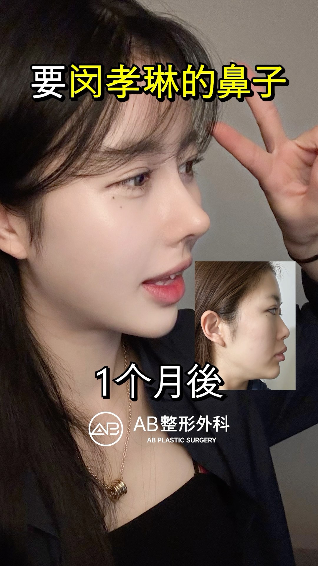 根本換了一張臉！鼻子這麼美？ #shorts