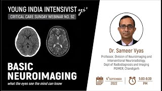 BASIC NEUROIMAGING : PROF SAMEER VYAS ( NEURORADIOLOGY PGI CHD)