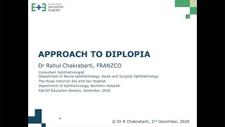 Approach to diplopia (webinar held on 2 December 2020)