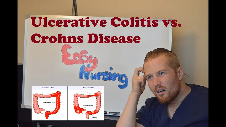 Ulcerative Colitis vs. Crohns Disease - NCLEX Review