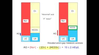Metabolic Acidosis - Anion Gap -- M Lam