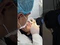 ពត់ធ្មេញ - how to fix braces #dentist #teethdecay #shorts