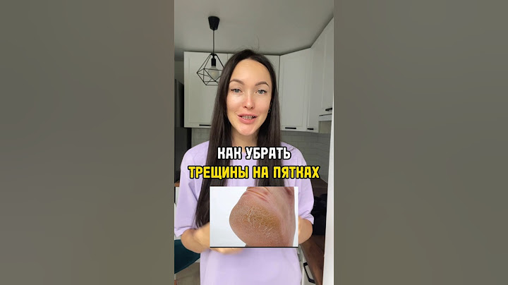 ТРЕЩИНЫ на ПЯТКАХ как избавится в домашних условиях.