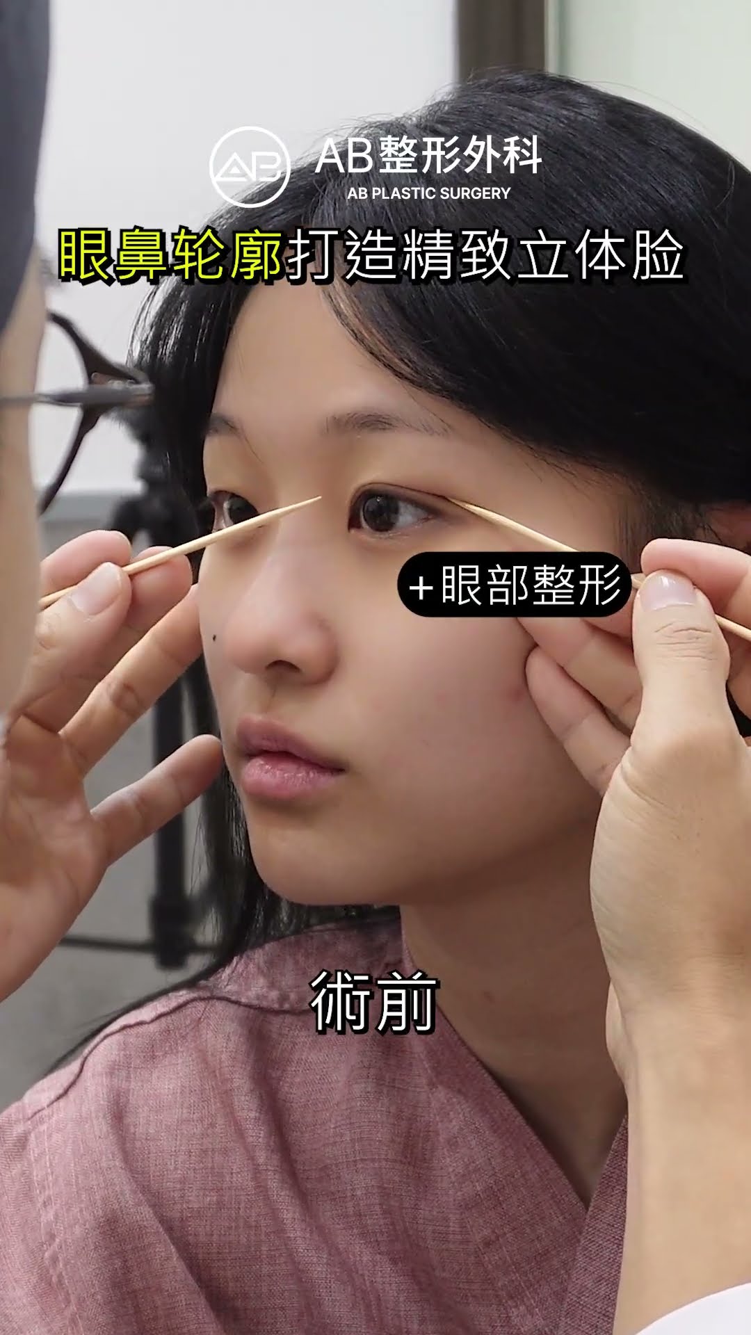 韓國全臉整形前後｜變美的完整過程公開 #shorts