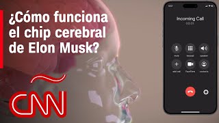 Así funciona el chip cerebral de Elon Musk