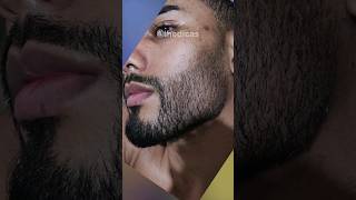 9 Meses Usando Minoxidil Evolução Minoxidil