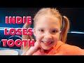 Indie Loses A Tooth At Cooker Man