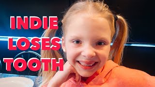 Indie Loses A Tooth At Cooker Man