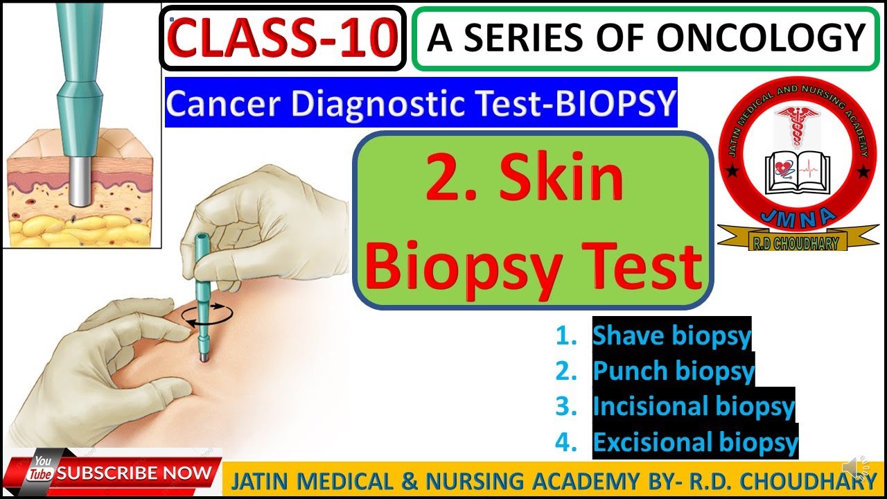 Skin Biopsy Test Oncology Shave Biopsy Punch Biopsy Test skin-biopsy-test-oncology-shave-biopsy-punch-biopsy-test