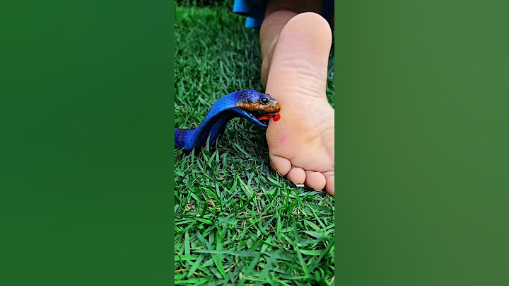 A COBRA PICOU O PÉ DE KIMBERLLY 😱🐍😭 #help #cuidado #mood #snake #attack #comedy #shortsfeed #shorts