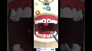 (اصبحت طبيب أسنان ) تجربة لعبةDentist Bling screenshot 4