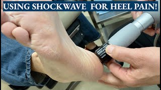 Using Shockwave Therapy to Cure Heel Pain