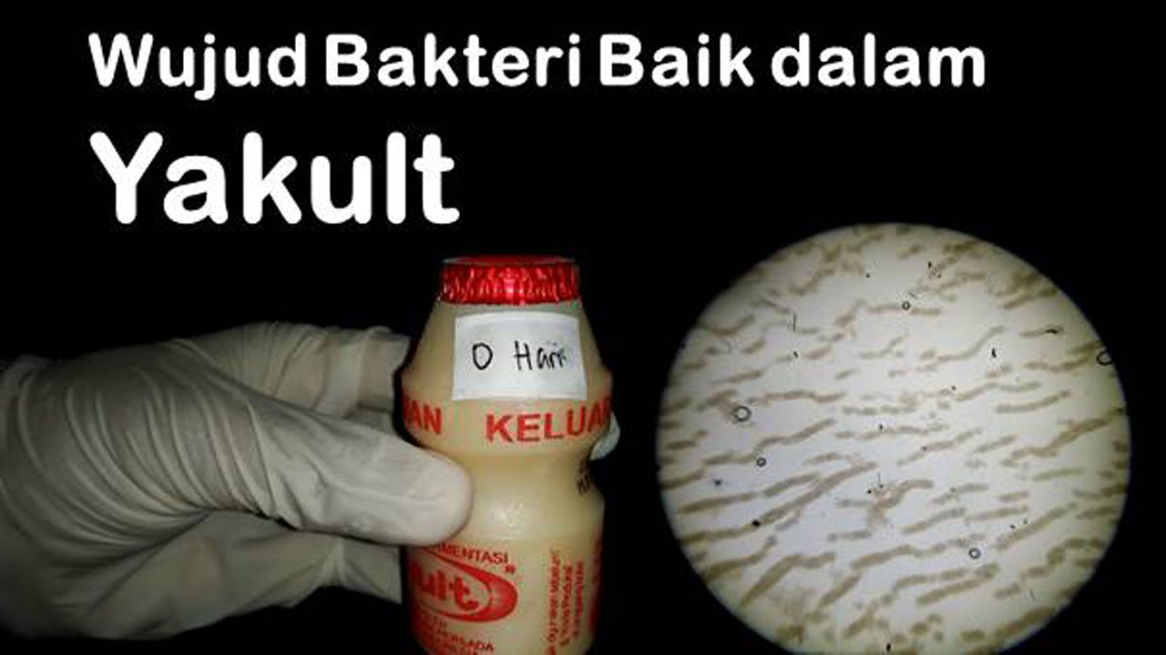 wujud-bakteri-baik-lactobacillus-casei-dalam-yakult-apakah-bisa