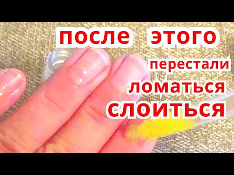 Слоятся Ломаются Ногти Что Делать ? Средство От Ломкости Ногтей Рецепт