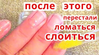 Слоятся Ломаются Ногти Что Делать ? Средство От Ломкости Ногтей Рецепт