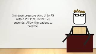 A Basic Introduction to Mechnical Ventilation: Chapter 8.4 - PEEP and Lung Recruitment
