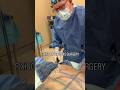 Fixing a previous surgery #bodytransformation #male #plasticsurgery #fix #bodysculpting