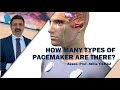 HOW MANY TYPES OF PACEMAKER ARE THERE?