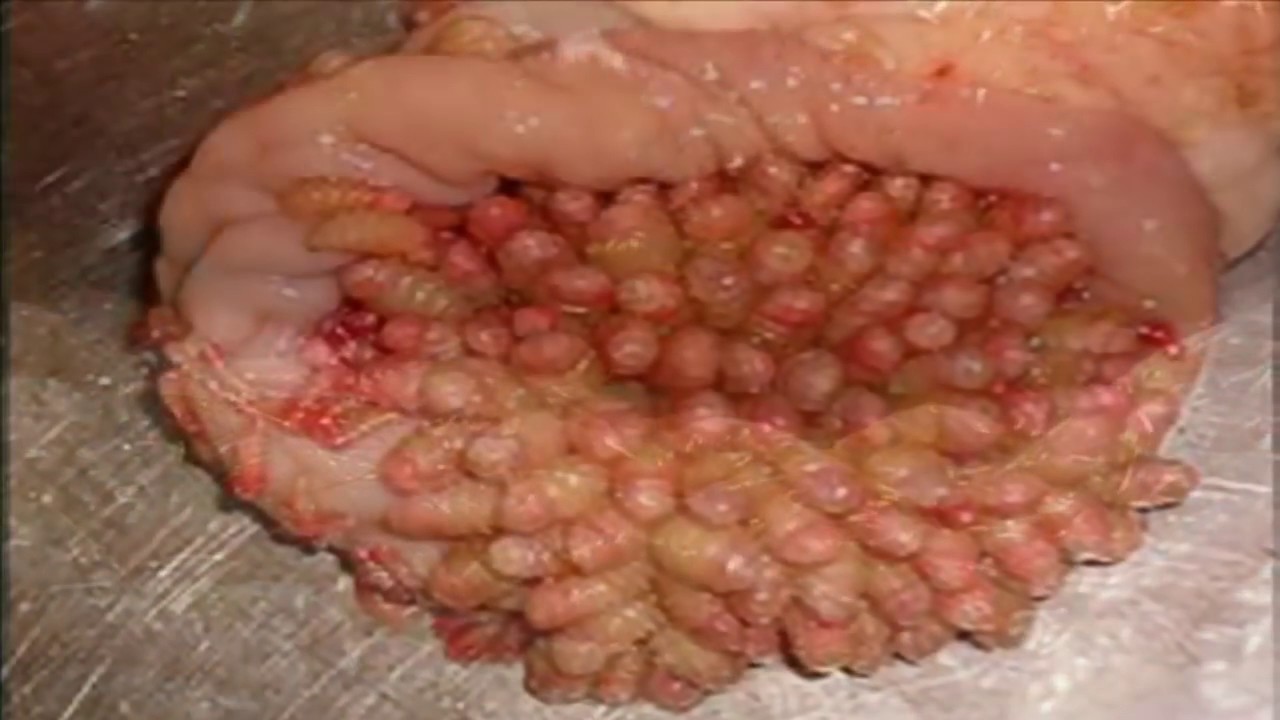 bot fly removal botfly popping bot fly facts removal bot fly removal botfly popping bot fly facts removal