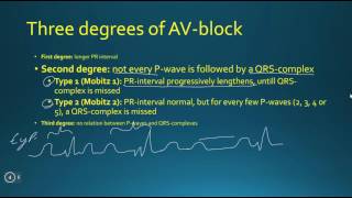 AV-block (3 minute medicine)