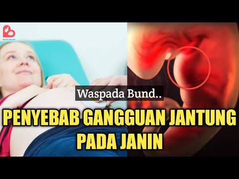 Cara Agar Jantung Janin Sehat