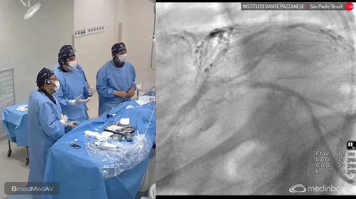 IVUS-Guided PCI To LCx