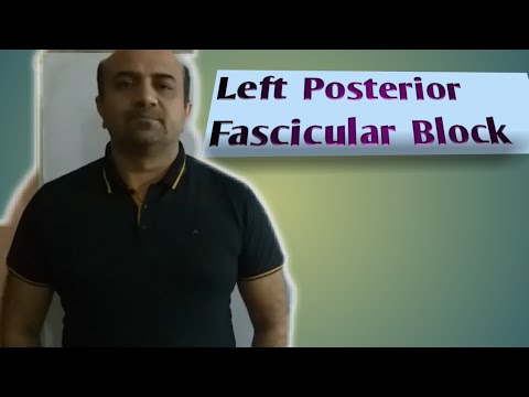 ecg....left-posterior-fascicular-block(lpfb)