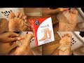 I Tried A Foot Peel Mask (Removing Dead Skin Extremely Satisfying)