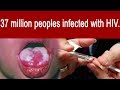 Aone punjabi tv  37 million peoples infected with hiv 