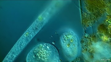 Spirostomum and Stentor