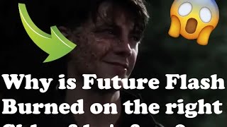 Why Savitar Barry Have A Burned Face? - The Flash 3X21