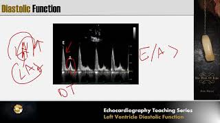 Lecture 6 - LV Diastolic Function