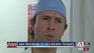 New procedure to help epilepsy patients