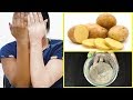 15 Minutes Skin Whitening Potato Facial Bleach | Get Fair, Spotless, Glowing Skin 100% Works