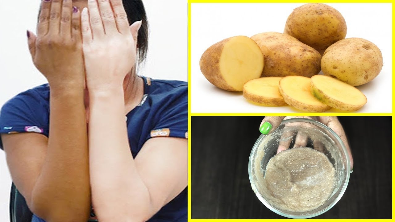 Skin Whitening Potato Facial Bleach Get Fair Spotless Glowing Skin At Home Youtube skin whitening potato facial bleach get fair spotless glowing skin at home