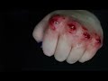 End of video