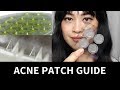 Guide to Acne Patches: Hydrocolloid, Treatment, Microneedle | Lab Muffin Beauty Science
