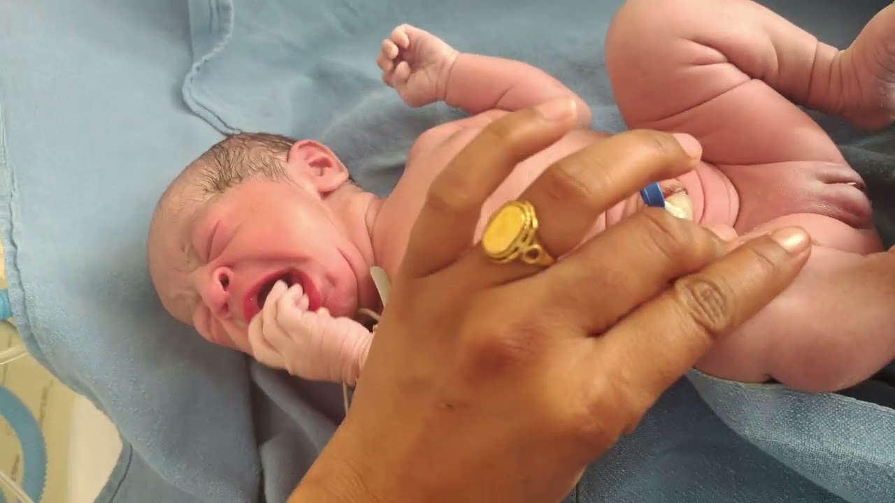 Injection Vitamin k💉💉👶🩺#ytshorts #viralvideo #trending #care #cute #babydevelopment 