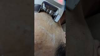 Terapie anti age ! Facelifter! #skincare #beauty #antiaging #advancefacials