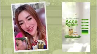 TESTIMONI HELWA BEAUTYCARE - ACNE JOURNEY