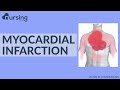 Myocardial Infarction - Lets break this down into simple terms (Nursing School Lesson)