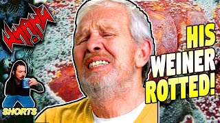 His Weiner Fell Off- Internet Shorts