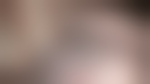 VATS Right Lower Lobectomy for Pulmonary Sequestration