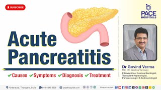 Acute Pancreatitis - Symptoms, Causes, Diagnosis, Treatment, Risk Factors | Dr Govind Verma